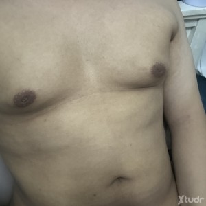 Xtudr - chubboy: bot, no port, can go to u