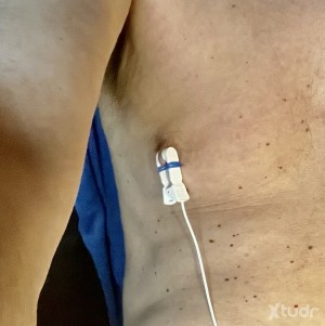 Xtudr - PEZONEROCBT: Pasivo.Pezonero Propón…
Hombre vocioso
