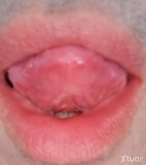 Xtudr - Xoxe: Hola a todxs. Busco aventuras sexuales. Mr gustaría que fuesen divertidas y discretas.