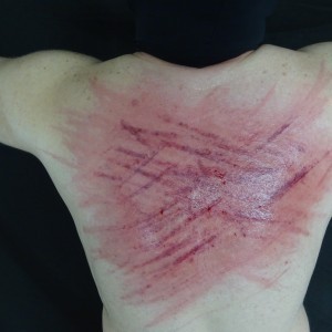 Xtudr - slavepy: I'm a vicious and MASOCHISTIC submissive, I'm into testicle torture, nipple torture, wax play all over my body, humiliation...