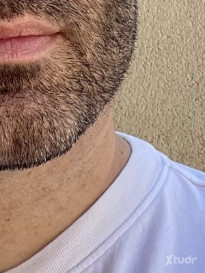 Xtudr - AmoSPH: Barba, vello y masculino. 
Busco zorrita pitocorto. 
Prefiero cuerpo lampiño. 
SPH para relación seria. 