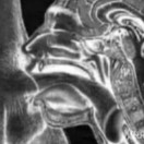 Xtudr - Sustituyendo: En proceso