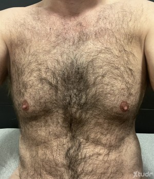 Xtudr - OSETEPASIVO53: pasivo, calvo, con un poquito de pluma, entregado en el sexo, con ganas de aprender más para hacer disfrutar.
Busco u...