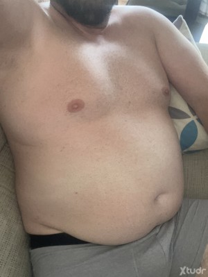 Xtudr - caracol: The most normal thing