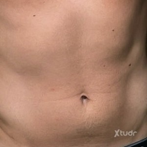 Xtudr - eescupeme: 