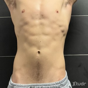 Xtudr - angeloMaster: Cashmaster italiano
190 cm | 21 cm di cazzo
Cerco sottomessi seri, rispettosi e generosi.
Se sai stare al tuo posto e ...