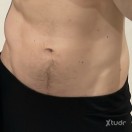 Xtudr - perraencelo: 
