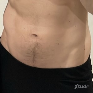 Xtudr - perraencelo: 
