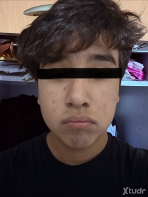 Xtudr - Alex_89: I would like a jockstrap I'm a young guy