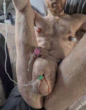 Un hombre desnudo aparece tumbado con las piernas abiertas, en una escena explícita de carácter sexual y médico, con el pene erecto parcialmente cubierto de líquido blanco y el escroto muy hinchado en primer plano. Varias agujas, cánulas y tubos transparentes están insertados en el pecho, los muslos y la zona genital, incluido un catéter con conector verde en el escroto del que sale sangre visible por la piel. El torso velludo, los pezones, el abdomen y la barba recortada quedan parcialmente encuadrados, mientras el fondo muestra una cama o superficie acolchada con material sanitario, cables y bolsas, creando una impresión de procedimiento extremo, fluidos corporales, perforaciones y práctica de modificación corporal genital.
