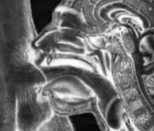 Xtudr - morboslip: No translation needed, 