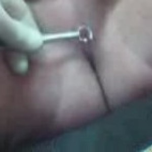 Xtudr - Speculum: Submissive bottom for medical games with mature experienced dominant person. Private or public check-ups with assistants. ...