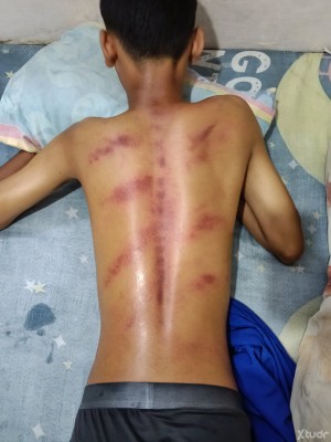 Xtudr - Amo19dominante: I'm looking for a submissive slave to beat until exhaustion, to do fisting with my entire arm inside him, to have hi...
