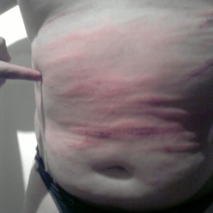 Xtudr - slavepy: I'm a vicious and MASOCHISTIC submissive, I'm into testicle torture, nipple torture, wax play all over my body, humiliation...