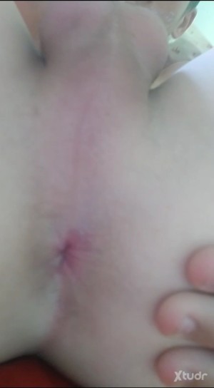 Xtudr - Alonsoquierefisting: Quién quiere desgarrarmelo bien con puños y
orazos dobles hasta sacarme el prolapso con
las rodillas hacia el p...