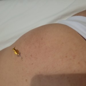 Xtudr - jmzta6io: I give injections