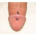 Xtudr - Piercings en los genitales dydoe