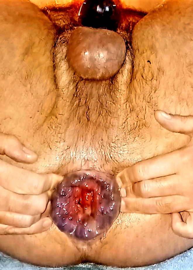 Xtudr - Fisting a perras Fister que controle prolapso? Ya tengo rosa pero quiero mas diametro y que me den caña y salga sola.