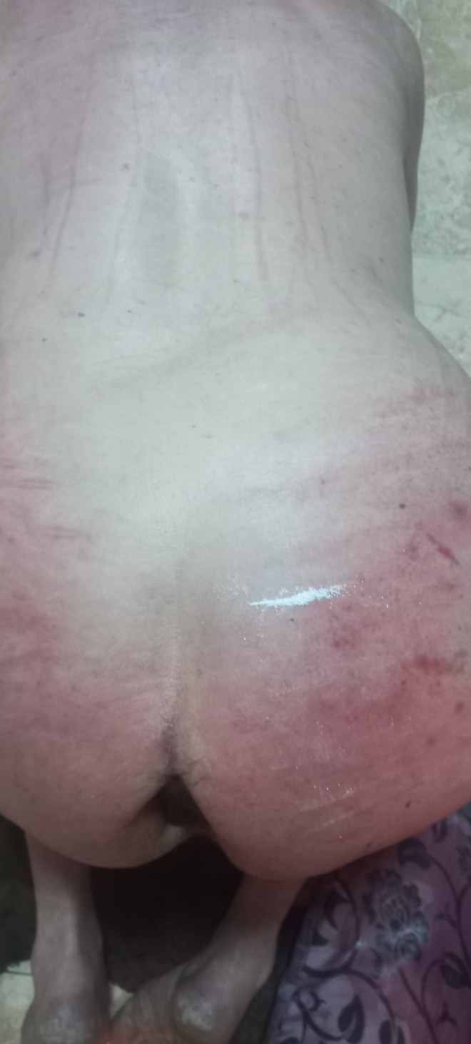 Xtudr - Mucho dolor esclavo con pocos limites material y sitio en Horta busco a Macho kabron que me use y torture ahora para su placer; recibo de rodillas, cinturon de castidad, pinzas en pezones y collar de perra Señor.

