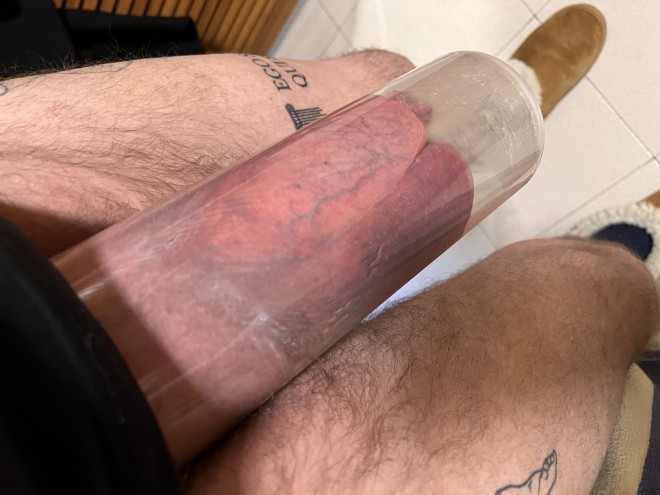 Xtudr - PUMPER,DILDOS,FIST,HUEVAZOS Alguien en Madrid aficionado al pumper? Conoceis algun grupo o pagina web de esta tematica? Yo llevo muchos años jugando con las bombas de vacio..