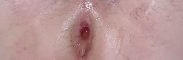 Xtudr - Dilatación anal dildos plug...  