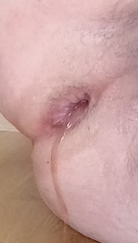 Xtudr - Dilatación anal dildos plug...  