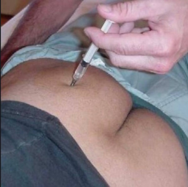 Xtudr - LA CASA DEL DOLOR. Intercambio experiencias e ideas para tortura  Pongo inyecciones en el culo a esclavos jovenes. Muchas y dolorosas 