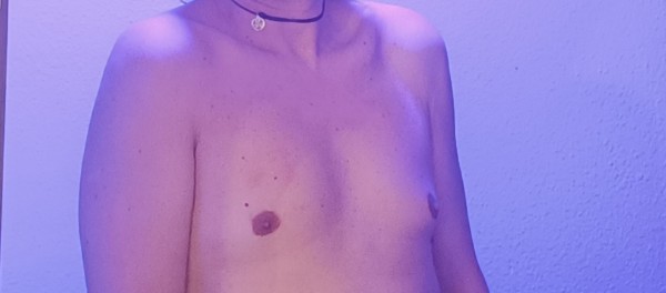 Xtudr - Nenas para Parejas dos meses en hormonas, poco pecho aun