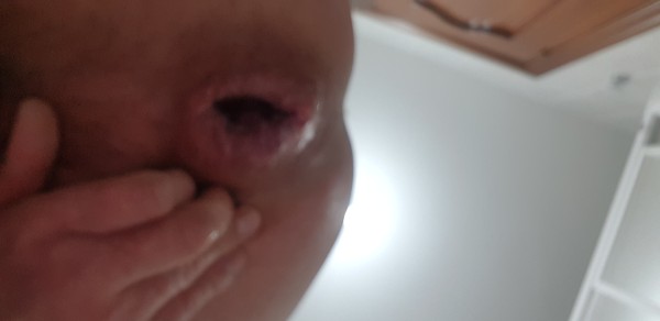 Xtudr - Hard Fisting 