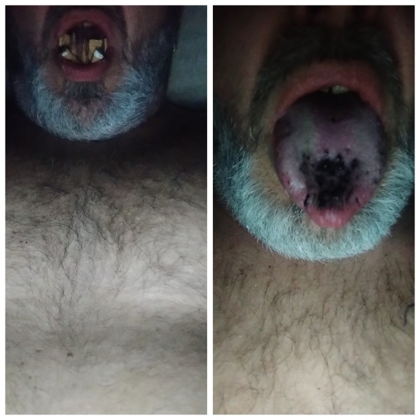 Xtudr - Perros cenicero I'm looking for dominant Spanish or foreign men, 20 years old or older, in the Alicante province who will treat me like the human garbage I am. I'll get on my knees and serve as your human ashtray for you to throw your cigarette butts in, smoke your cigars and cigarettes, and put them out on my filthy, faggot tongue. Always wearing a dog collar. I'm here to serve you and your friends, being everyone's faggot whore. If you like what you read, send a message. I have photos of myself as a human ashtray. I use Google Translate to translate the texts; I don't know English.

