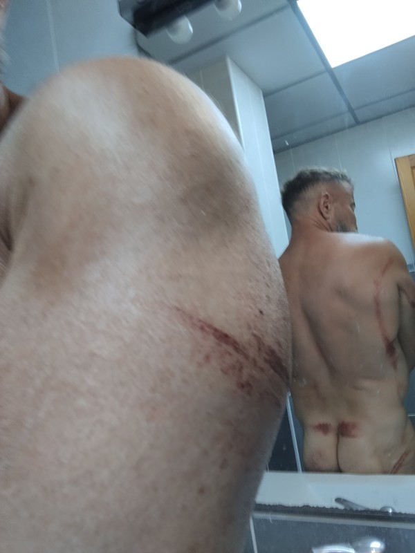 Xtudr - Sado extremo y exclusivo y filmar vídeos de torturas salvajes para promocionarse y que te dé morbo y beneficios que quieran  Marcas en todo mi cuerpo 