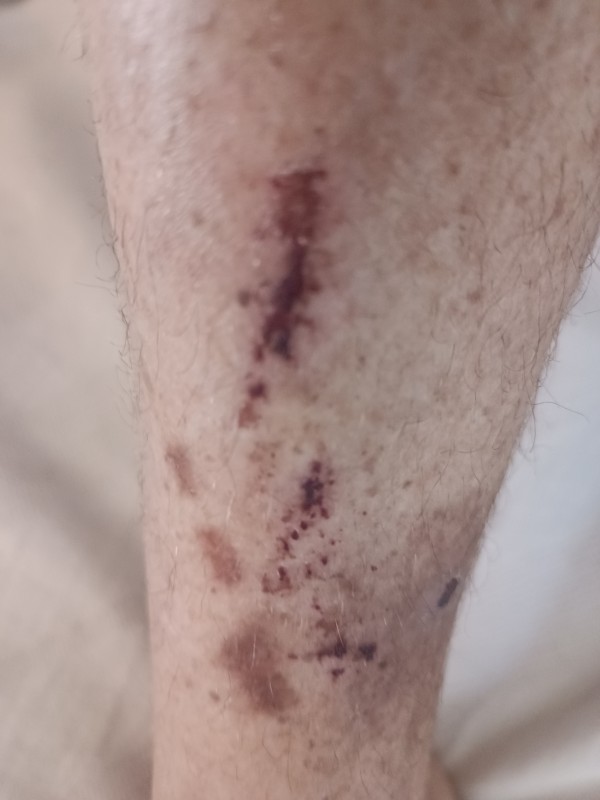 Xtudr - Sado extremo y exclusivo y filmar vídeos de torturas salvajes para promocionarse y que te dé morbo y beneficios que quieran  Marcas 