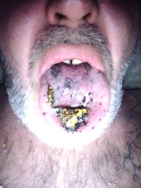 Xtudr - Perros cenicero Marica come cigarros y puros.
Busco ser cenicero humano, por eso deseo encontrar machos dominantes españoles o extranjeros que me hagan su cenicero humino de rodillas, cuatro p para servirlo a usted Ó también a sus amigos y que se rían de lo patético y el asco que doy por ser marica y bola de grasa. Estoy en la provincia de Alicante y me desplazó también a Valencia capital si desea tener a un cenicero humano bajo sus pies para humillarlo y tratarlo como una basura con patas que es lo que soy por ser una bola de grasa