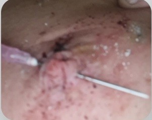 Xtudr - Pezones maleables, acrescentes y torturables Tortura de pezones sin límite, no digo no a nada