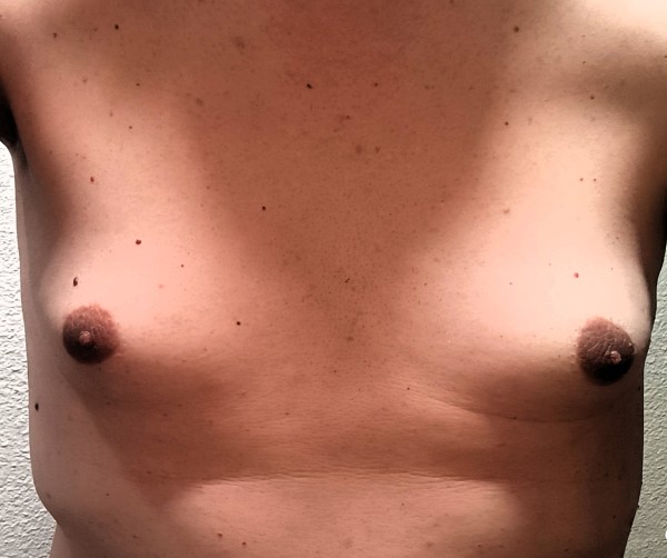 Xtudr - CASTING DE ZORRAS Cross en transicion con hormonas, busca machos con sitio, para crear contenido.
