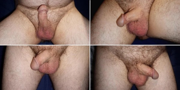 Xtudr - Sensibilidad y sentidos https://thepiemel.com/es/piemelgallery/
Galeria de pililas.
En la foto pene polaco tras una circuncisión adulta